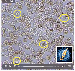 Blood under a microscope - GIF-blood-content.png